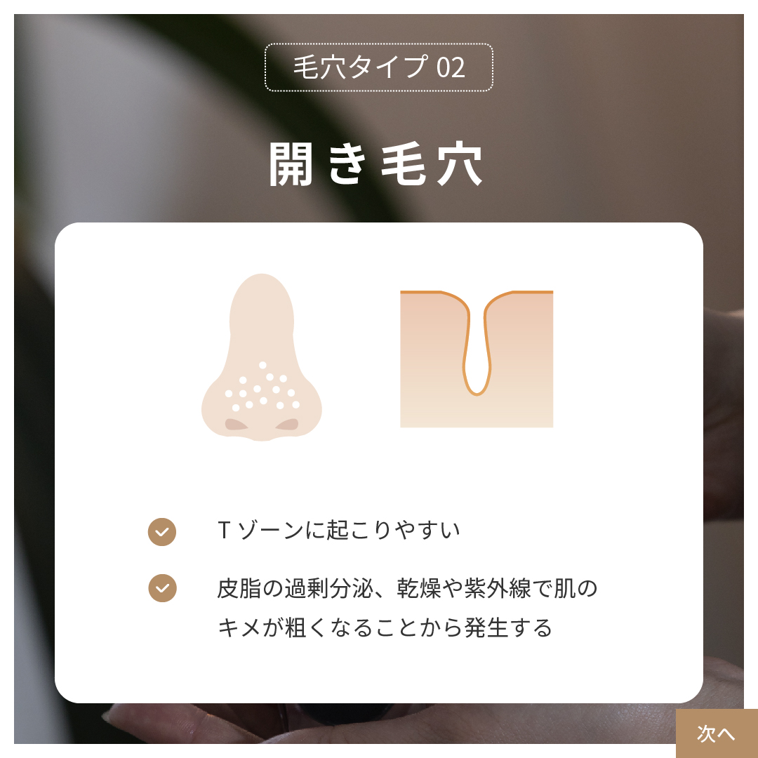 【毛穴タイプ2】乾燥による開き毛穴